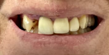 Smile gallery case 7, before