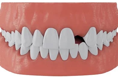 Tooth Replacement in Burke, VA
