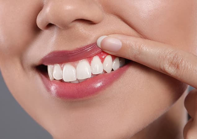 Gum Disease Treatment