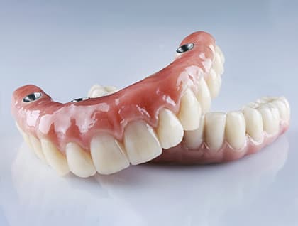 Implant Dentures