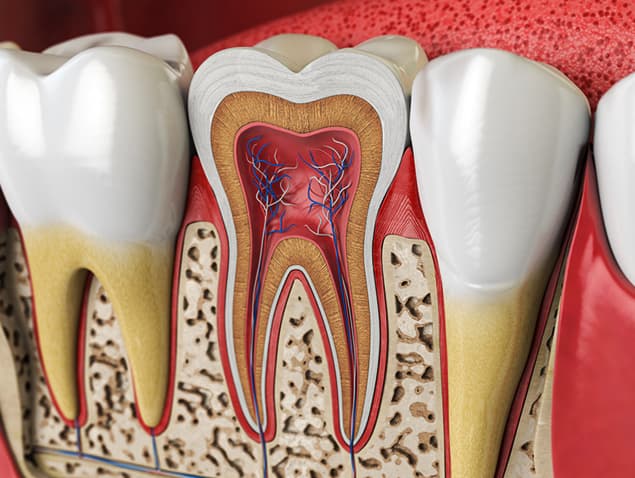 Root Canal Therapy